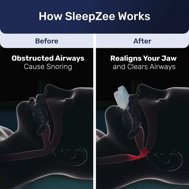 Vitalsleep Mouthpiece image