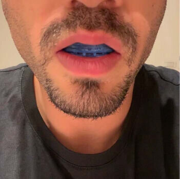 Vitalsleep Mouthpiece image